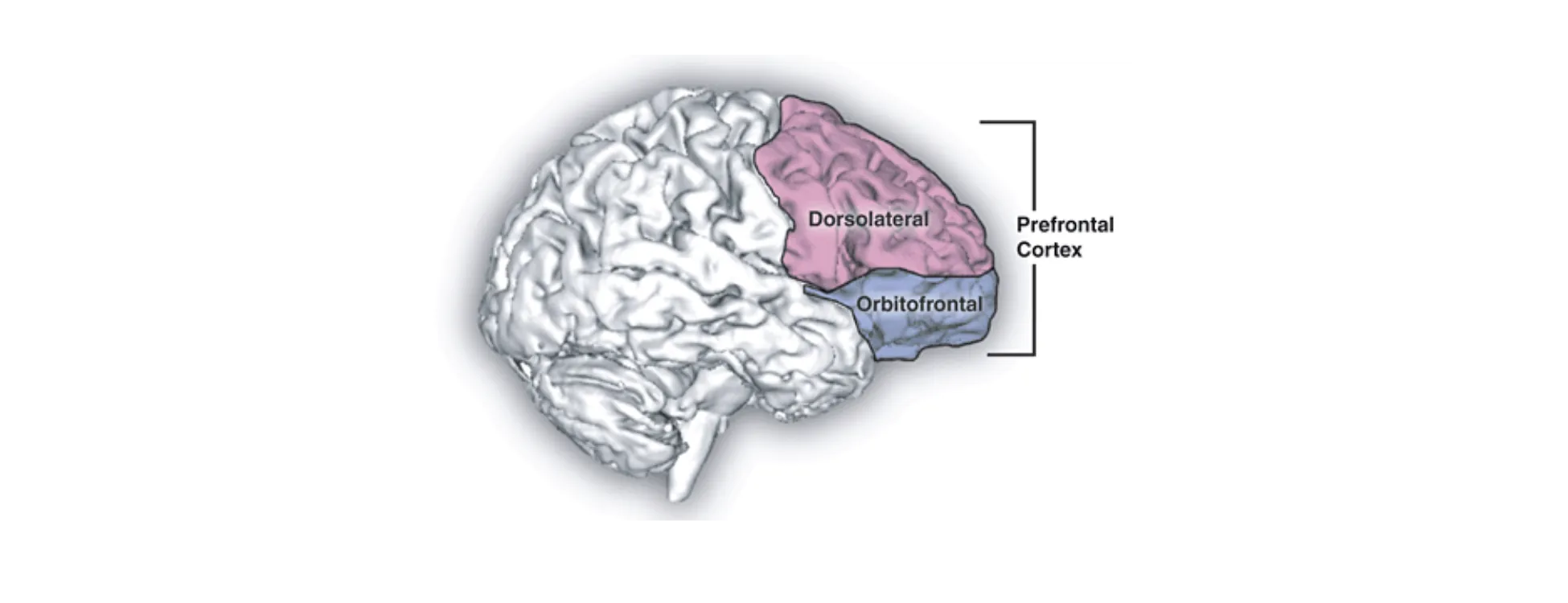 A 3D surface rendering of the brain with dorsolateral and orbitofrontal cortex highlighted.