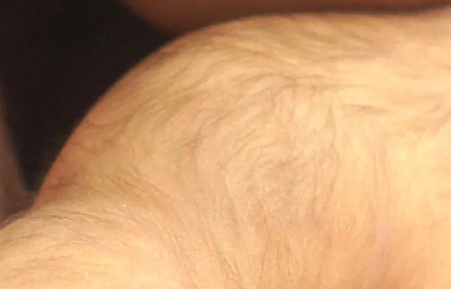 A close-up of human skin showing fine hairs covering the skin’s surface.