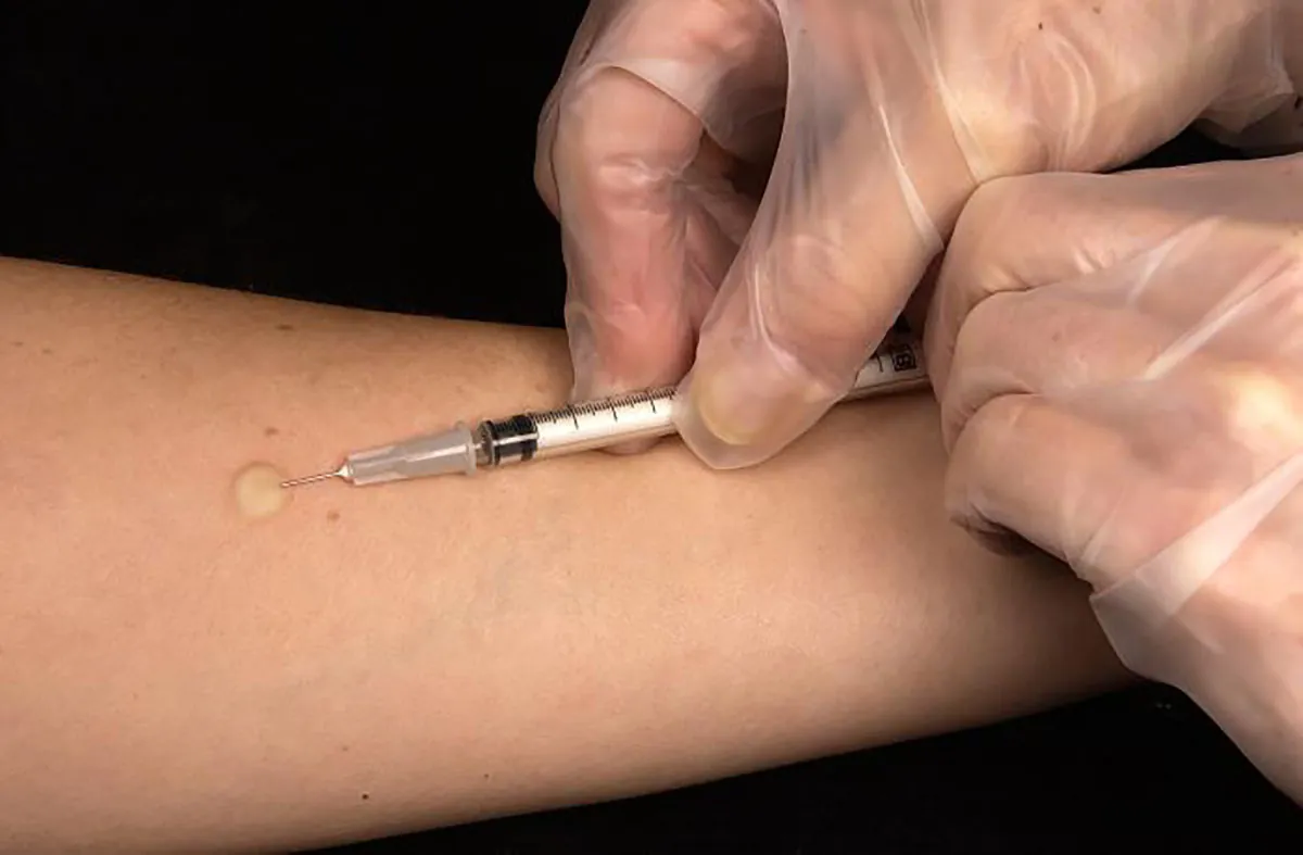 A photograph shows a healthcare provider administering needle injection into patient's arm with visible wheal.