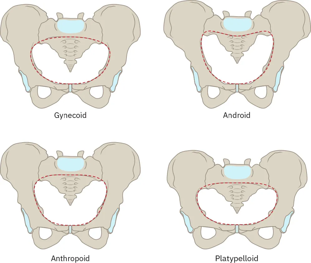 Image of four female pelvis bone shapes: gynecoid (oval), android (heart shaped), anthropoid (rounded upside down trapezoid shape), and platypelloid (bean shaped).