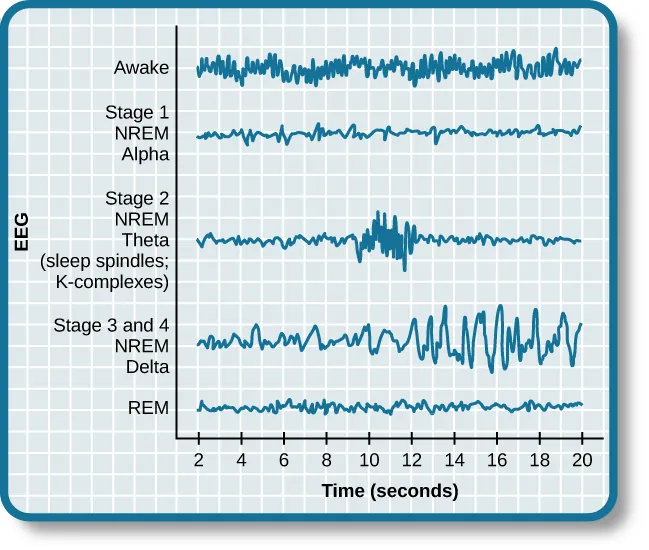 A graph has a y-axis labeled “EEG” and an x-axis labeled “time (seconds.) Plotted along the y-axis and moving upward are the stages of sleep. First is REM, followed by Stage 3 and 4 NREM Delta, Stage 2 NREM Theta (sleep spindles; K-complexes), Stage 1 NREM Alpha, and Awake. Charted on the x axis is Time in seconds from 2–20 in 2 second intervals. Each sleep stage has associated wavelengths of varying amplitude and frequency. Relative to the others, “awake” has a very close wavelength and a medium amplitude. Stage 1 is characterized by a generally uniform wavelength and a relatively low amplitude which doubles and quickly reverts to normal every 2 seconds. Stage 2 is comprised of a similar wavelength as stage 1. It introduces the K-complex from seconds 10 through 12 which is a short burst of doubled or tripled amplitude and decreased wavelength. Stages 3 and 4 have a more uniform wave with gradually increasing amplitude. Finally, REM sleep looks much like stage 2 without the K-complex.
