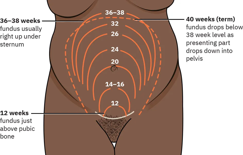 Diagram of fundal height showing location of fundus at weeks 12, 14-16, 20, 24, 26, 32, 36-38, and 40; 12 weeks labeled fundus just above pubic bone, 26-38 weeks labeled fundus usually right up under sternum; 40 weeks (term) labeled fundus drops below 38 week level as presenting part drops down into pelvis.