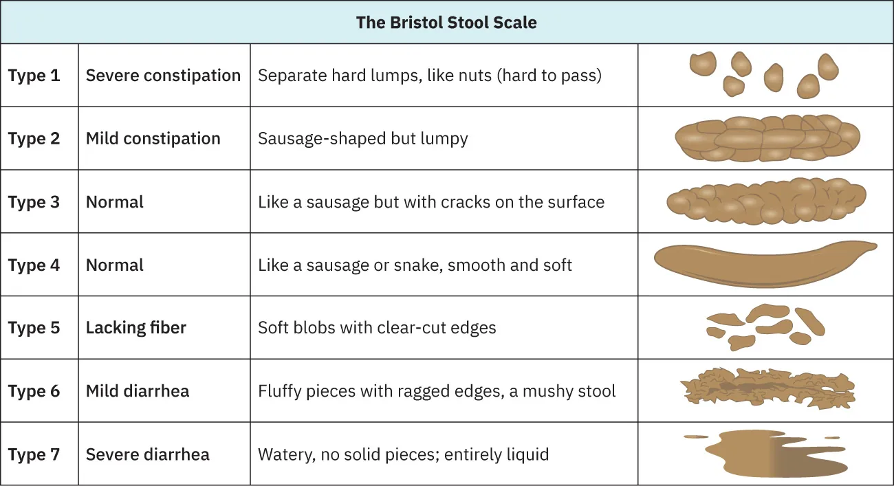 A chart depicting the Bristol Stool Scale, which is a medical aid designed to classify the form of human feces into seven categories. Each type is numbered 1 through 7 and is associated with a specific condition, such as 'severe constipation' for Type 1, or 'severe diarrhea' for Type 7. Descriptions and illustrative representations accompany each type, ranging from 'separate hard lumps' for Type 1 to 'watery, no solid pieces' for Type 7.