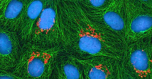 Each cell contains a large blue sphere with a cluster of orange ovals next to the sphere. A green web fills the rest of the cell.