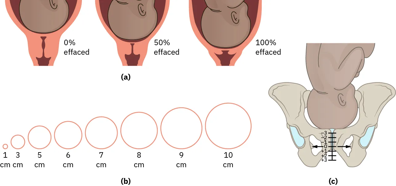 (a) Fetus at 0%, 50%, and 100% effacement. (b) Cervical effacement at 1, 3, 5, 7, 8, 9, 10 cm. (c) Fetal head station above/below the ischial spines (+3 to –3).