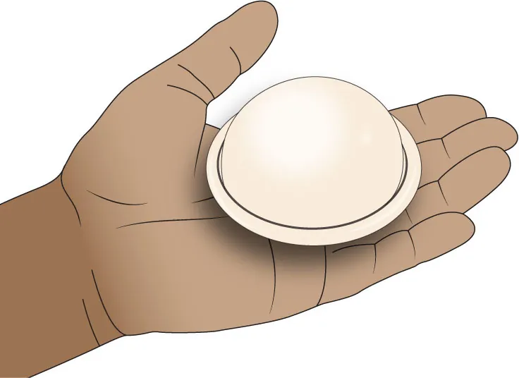 Image of a dome-shaped contraceptive diaphragm.