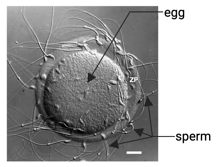 Photo of a large egg surrounded by many sperm.