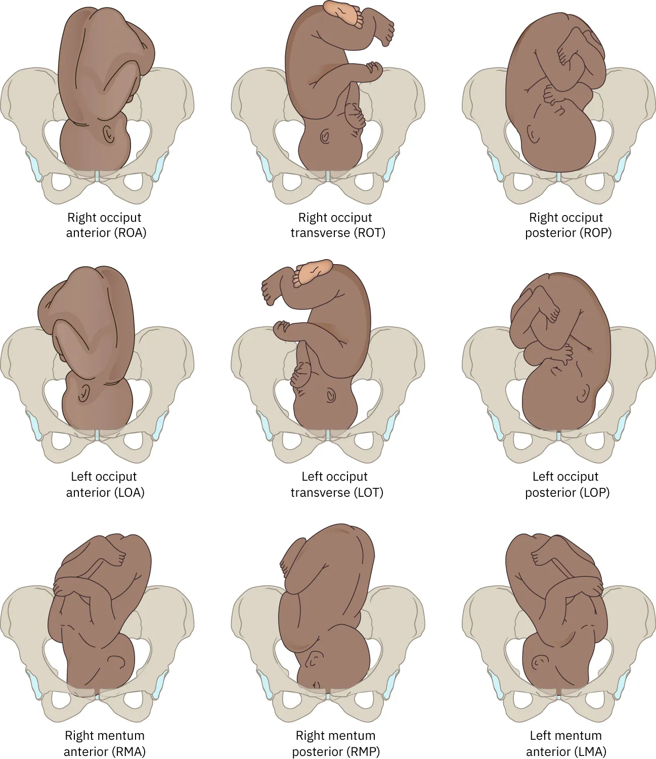 Various fetal positions in utero from head down, chin tucked and arms and legs close to body, to chin first, head extended.