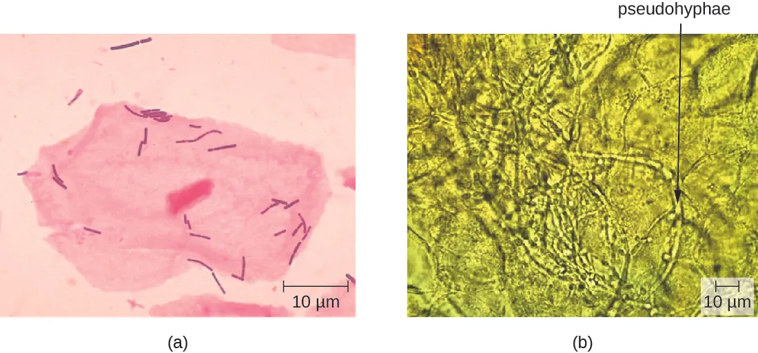 a) micrograph of large pink cell with a nucleus and smaller pink rod shaped cells. B) Micrograph of long tubes labeled pseudohyphae.
