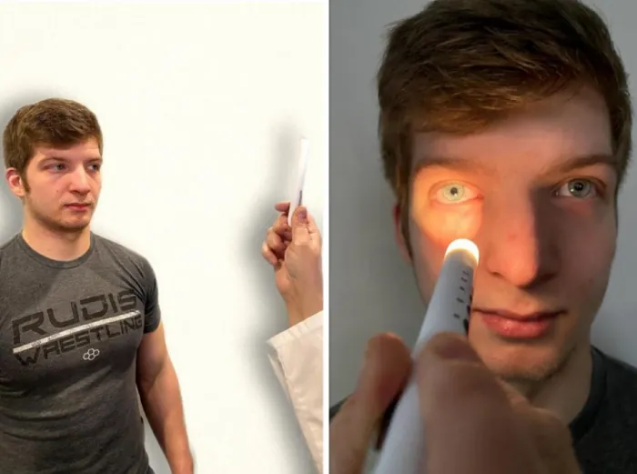 Photo showing assessment of simulated patient’s pupil reaction to light source