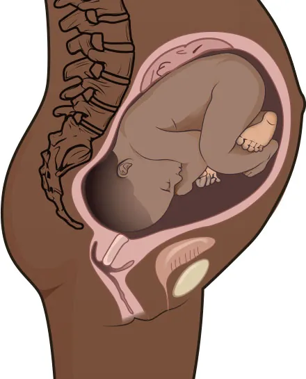 Image of fetus inside uterus, facing down, with back of head against pregnant person’s sacrum.