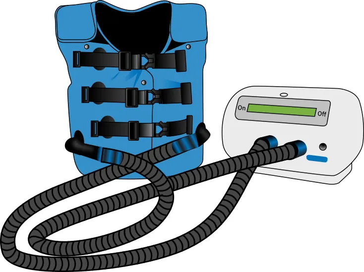 Diagram showing vest connected to machine designed to care for patient with CF.