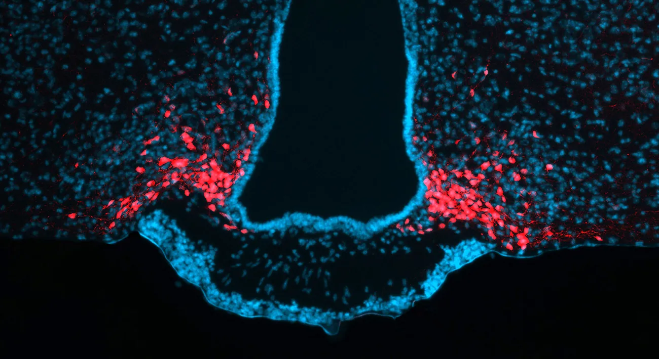 Neurons in the hypothalamus are visible in a micrograph that appears mostly dark blue. Some, AgRP neurons, concentrated toward the bottom of the tube shape in the frame, are highlighted in red.