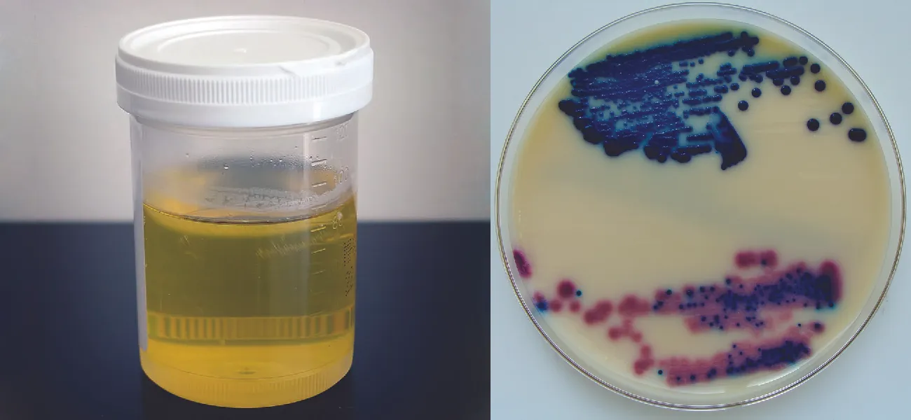 a small container filled with urine is shown on the left. The picture on the right shows a disc with a peach colored film that is spotted with red and blue spots.