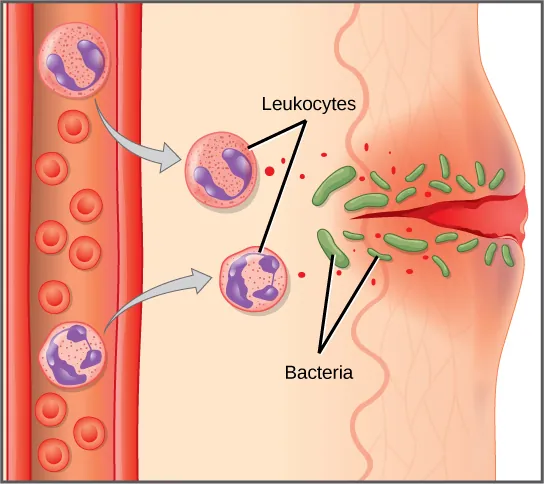 Illustration shows a capillary near the surface of skin that has a cut in it. Bacteria have penetrated the skin around the cut. In response, mast cells in the lower part of the skin tissue release histamines, and dendritic cells release cytokines. The histamines cause the capillary to become permeable. Neutrophils and monocytes exit the capillary into the damaged skin. Both the neutrophil and macrophage release cytokines and consume bacteria by phagocytosis.