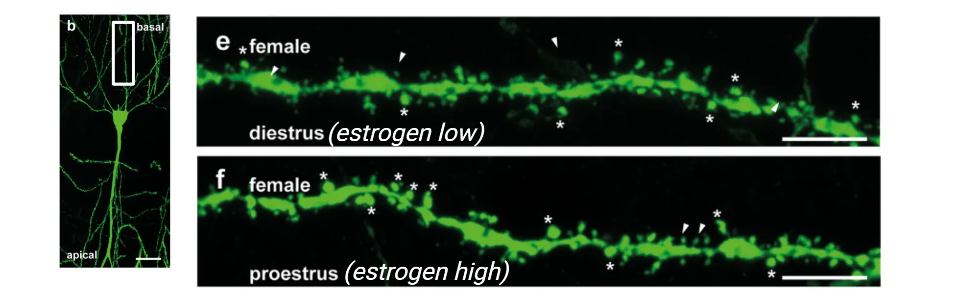 Fluorescent images of a dendrite with many spines on it. More spines are evident in the image from a proestrous (estrogen high) female than from a disetrus (estorgen low) female).