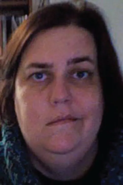 A photo of a woman with facial droop or ptosis on the right side of the face.