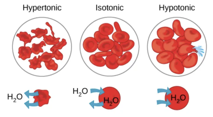 The left part of this illustration shows shriveled red blood cells bathed in a hypertonic solution. The middle part shows healthy red blood cells bathed in an isotonic solution, and the right part shows bloated red blood cells bathed in a hypotonic solution.
