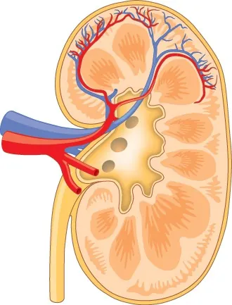 An illustration without labels shows the kidney, shaped like a kidney bean standing on end. Two layers, the outer renal fascia and an inner capsule, cover the outside of the kidney. The inside of the kidney consists of three layers: the outer cortex, the middle medulla, and the inner renal pelvis. The renal pelvis is flush with the concave side of the kidney and empties into the ureter, a tube that runs down outside the concave side of the kidney. Nine renal pyramids are embedded in the medulla, which is the thickest kidney layer. Each renal pyramid is teardrop-shaped, with the narrow end facing the renal pelvis. The renal artery and renal vein enter the concave part of the kidney, just above the ureter. The renal artery and renal vein branch into arterioles and venules, respectively, which extend into the kidney and branch into capillaries in the cortex.