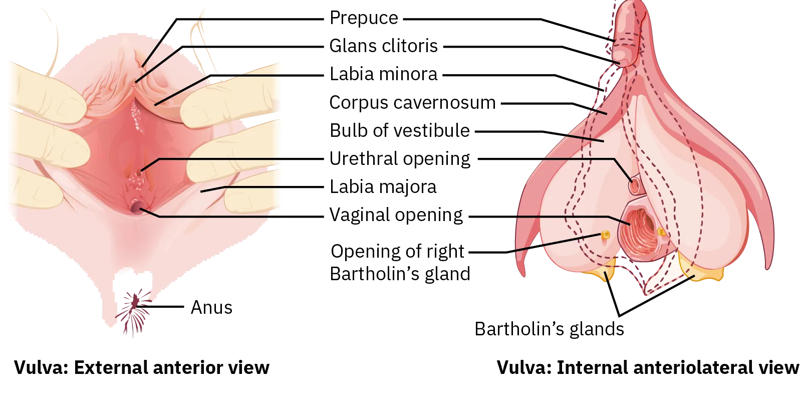 This diagram shows the parts of the vulva. The right panel shows the external anterior view and the left panel shows the internal anterolateral view. The major parts are labeled. These are the prepuce, glans clitoris, labia minora, corpus cavernosum, bulb of vestibule, urethral opening, labia majora, vaginal opening, Bartholin's glands, and opening of right Bartholin's gland.