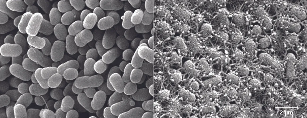Micrograph of oval cells with and without projections.