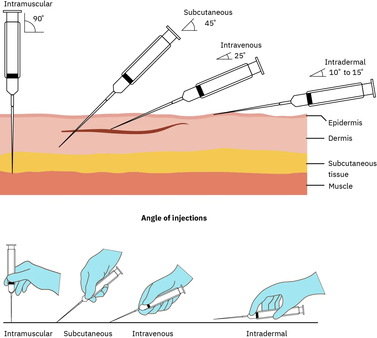 Diagram showing angle of injections for parenteral administration: intramuscular (ninety degrees), subcutaneous (forty-five degrees), intravenous (twenty-five degrees), intradermal (ten to fifteen degrees)