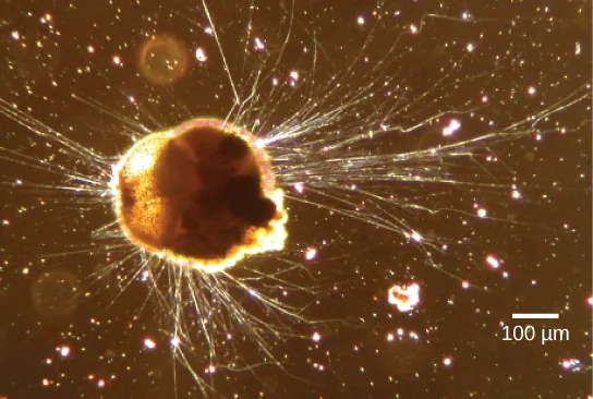 The micrograph shows a semi-round cell with long, hair-like projections extending from it.