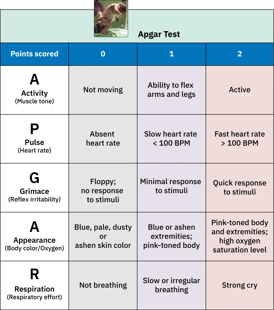 Apgar Test chart. A – Activity (Muscle tone), P – Pulse (Heart rate), G – Grimace (Reflex irritability), A – Appearance (Body color), R – Respiration (Respiratory effort). Columns for scores (0, 1, 2 for each category).
