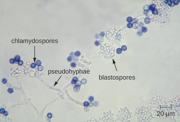 a) micrograph showing long strands with dark blue spheres labeled chlamydospores on the tips of the strands. Smaller clear spheres in clusters on the strand are labeled blastospores.