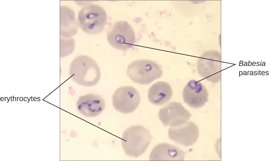 Micrograph of red blood cells with dark circles inside.