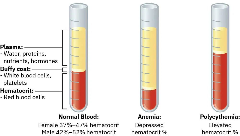 Graphic showing the differences between a normal HCT, decreased HCT, and an increased HCT.