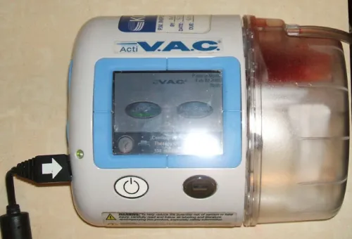 A close-up of an Acti V.A.C. Negative Pressure Wound Therapy device, showing its screen, power connection, and a reservoir containing reddish fluid from wound exudate.
