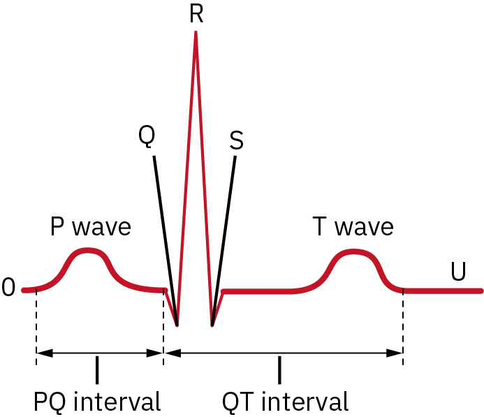 An example of an EKG recording shows the telemetry wave measurements. The reading is divided into the PQ and QT intervals. Points along the EKG are labeled O, P wave, Q, R, S, T wave, and U.