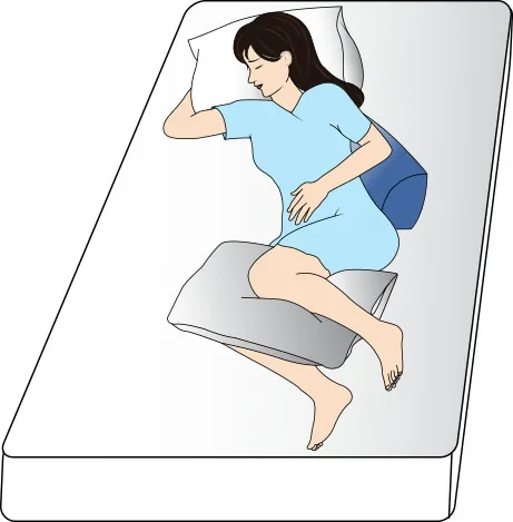 A color illustration showing a woman laying on a bed using pillows to maintain her position. There is a pillow at her back, under her head, and between her knees.