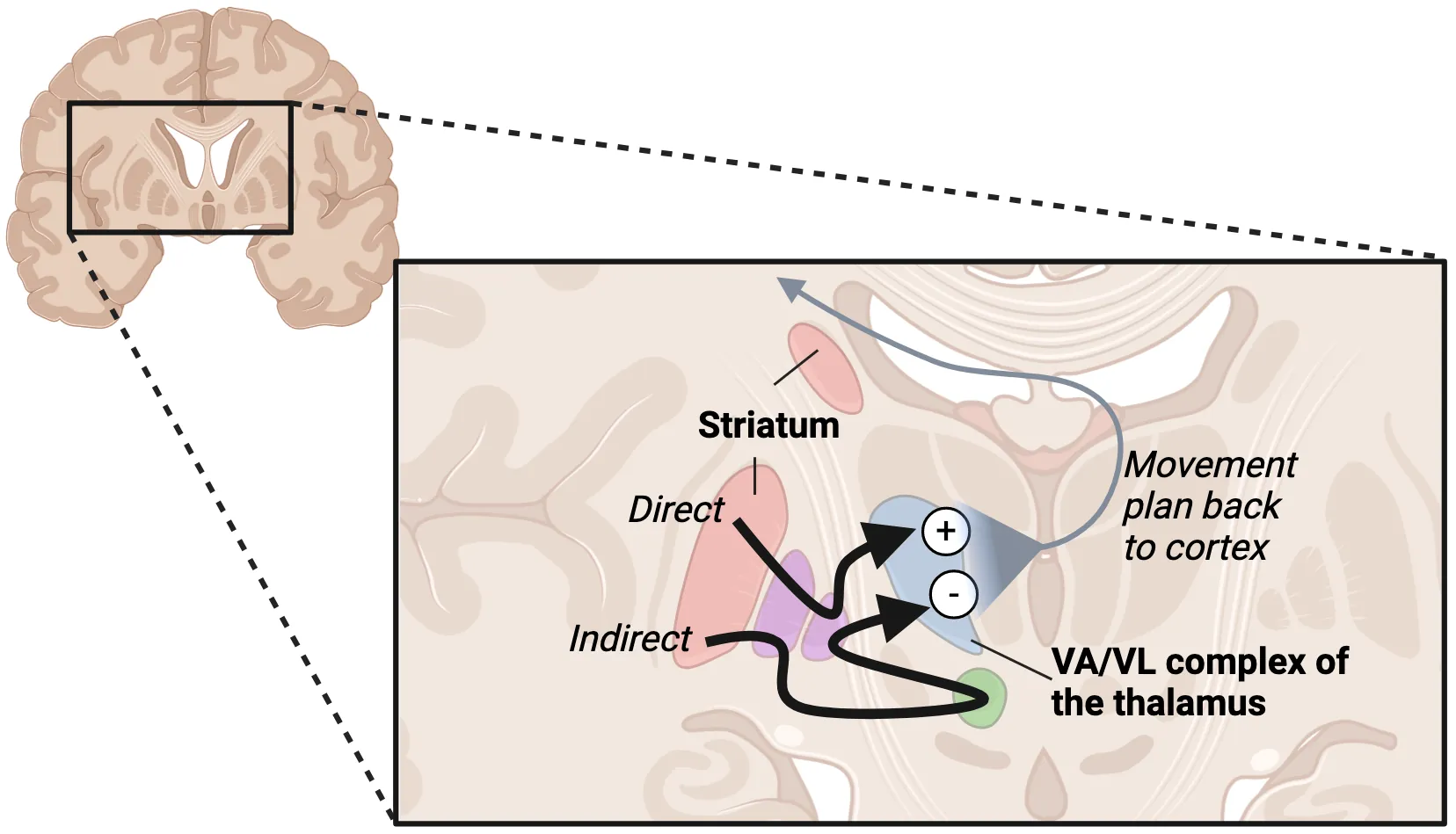 A diagram of a coronal slide of a human brain with zoom in showing rough pathways of direct and indirect pathways from striatum to VA/VL complex of thalamus.