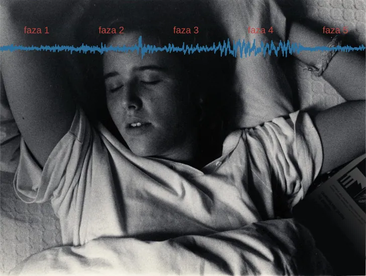 A photograph shows a person sleeping. Superimposed across the top of the picture is a line representing brainwave activity across the five stages of sleep. Above the line, from left to right, it reads stage 1, stage 2, stage 3, stage 4, and stage 5. The wave amplitude is highest in late stage 2, and near the end of stage 3 through stage 4. The wavelength I longer from late stage 2 through stage 4.