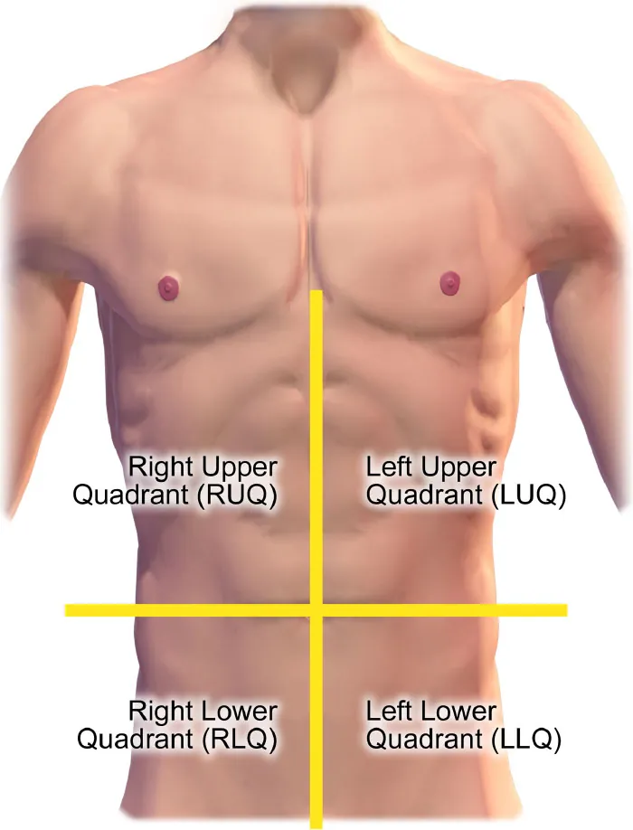 Graphic showing the four quadrants of the abdomen.