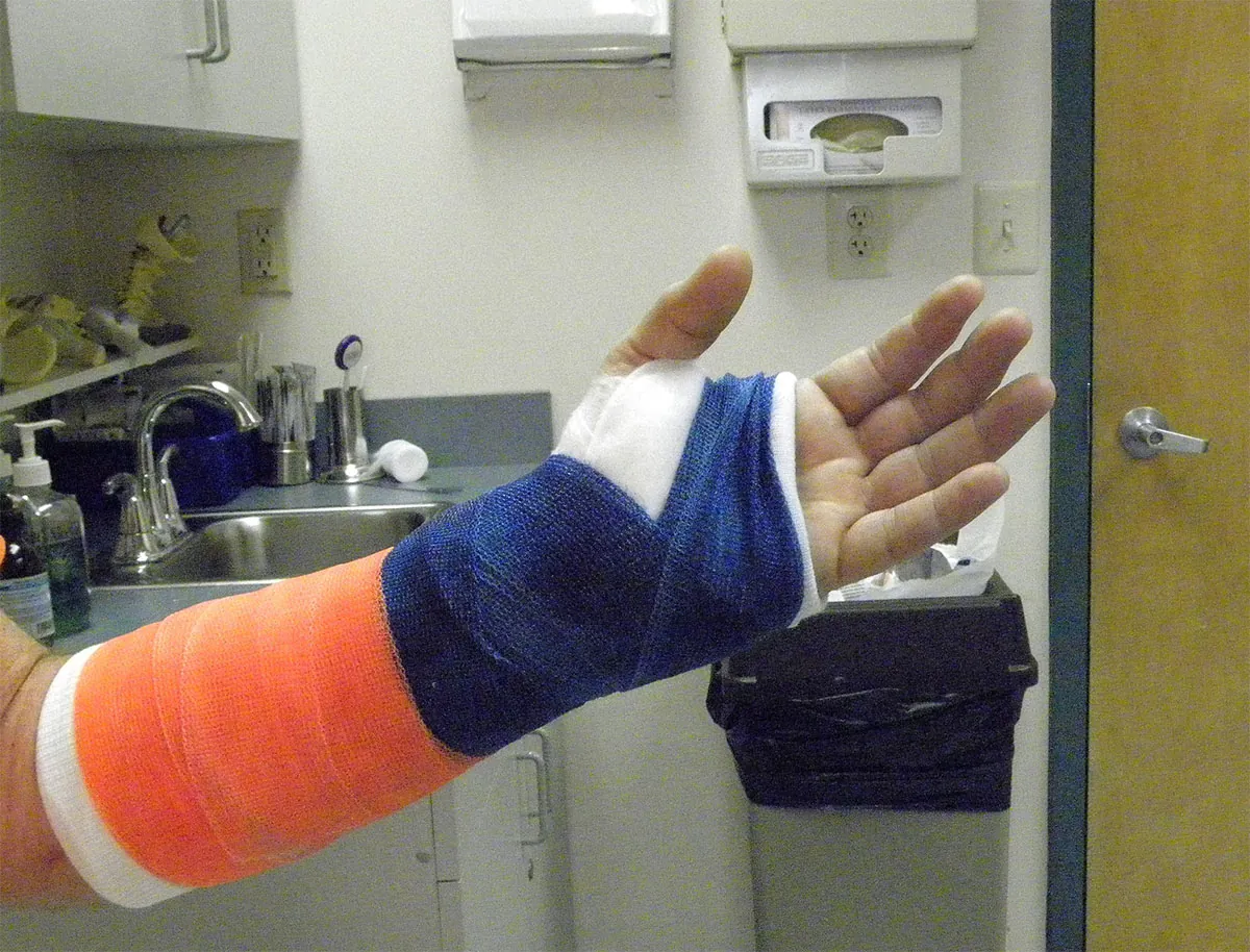 A photograph shows a patient’s arm in a cast.
