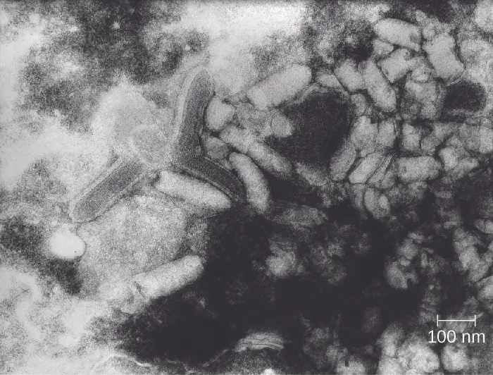 Micrograph of bullet shaped structures.