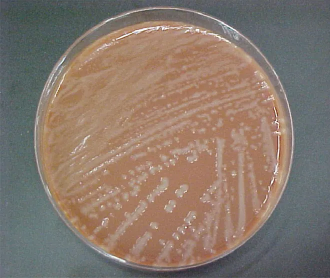 A micrograph of Haemophilus influenzae is shown. It looks like a brown disc with white streaks.