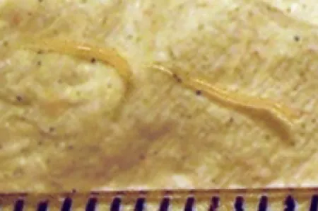 A photograph of a pinworm.