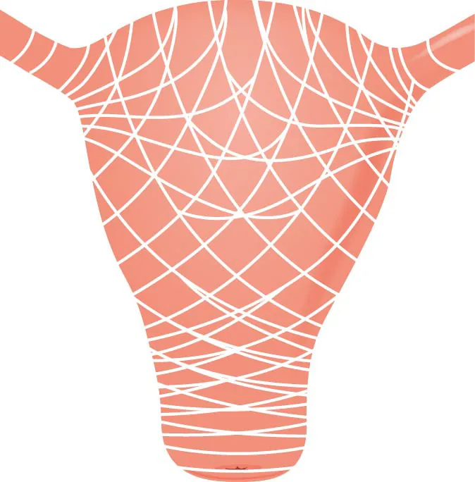 Image of muscles running throughout the uterus.