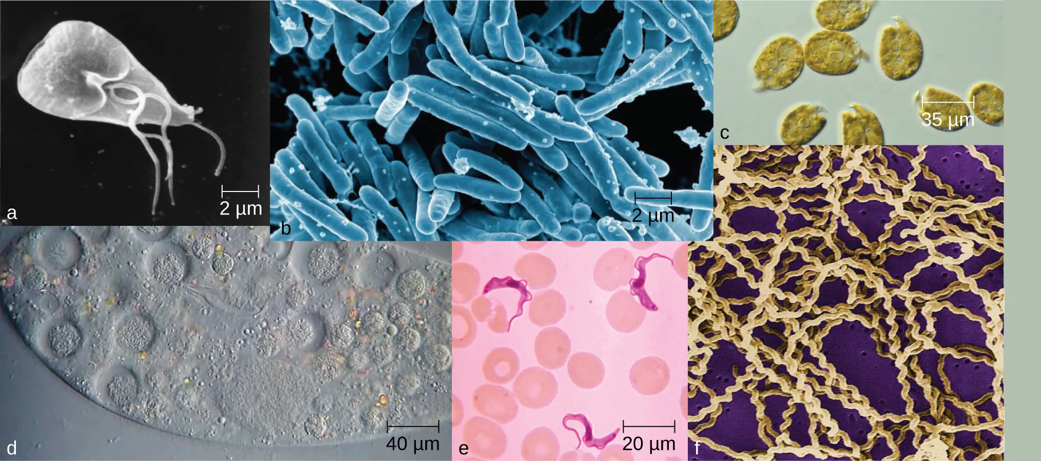 Photos of various mirobes. A) a triangular cell approximately 10 µm long with long flagella. B) Many rod shaped cells approximately 10 µm long. C) Round cells approximately 85 µm in diameter. D) a portion of a large oval over 200 µm in length with smaller spherical structures inside. E) Long, ribbon shaped cells approximately 20 µm in length. F) Many long spiral cells.