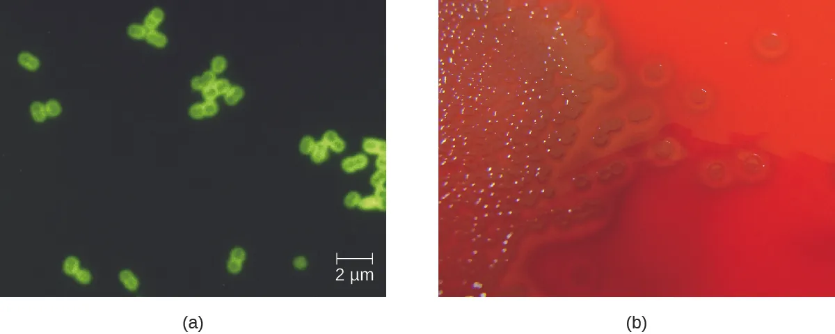 a)Micrograph of green closing circles in pairs on a dark background. Photograph of a red plate with brown colonies. Clearing is seen around the colonies.