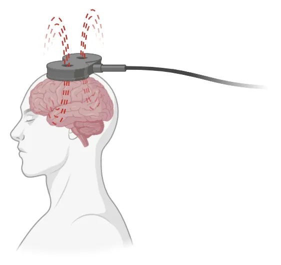 Diagram of human torso/head with TMS coil shown above the top of the head and red dotted lines representing magnetic fields.