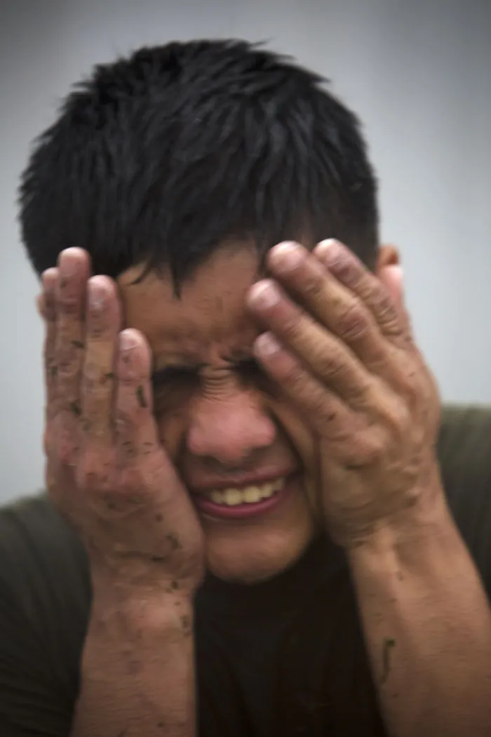 A color photograph shows a man in pain holding his face.