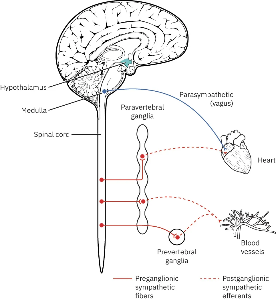 Diagram showing loss of sympathetic tone in neurogenic shock leading to parasympathetic response; labels show hypothalamus, medulla, spinal cord, paravertebral ganglia, parasympathetic (vagus), heart, prevertebral ganglia, blood vessels, preganglionic sympathetic fibers, postganglionic sympathetic efferents