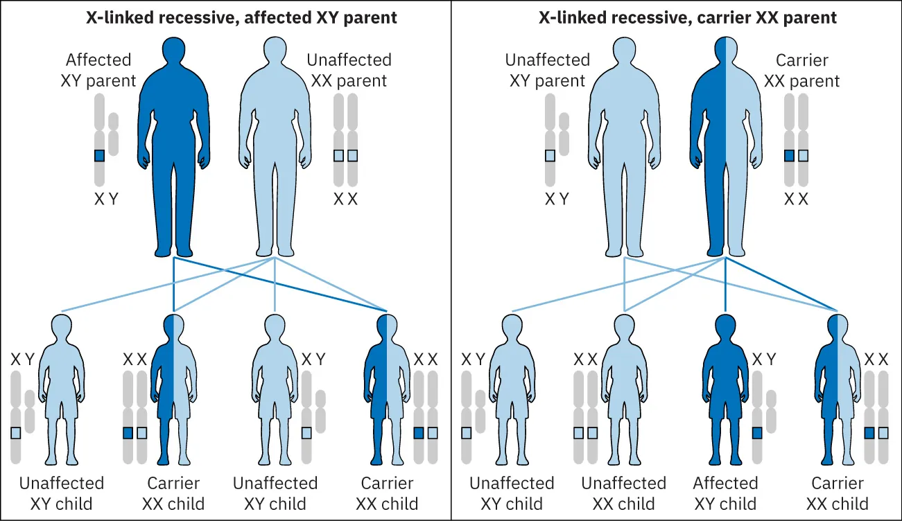 Chart of how diseases are transmitted to children from X-linked recessive, affected XY parent and x-linked recessive, carrier XX parent.