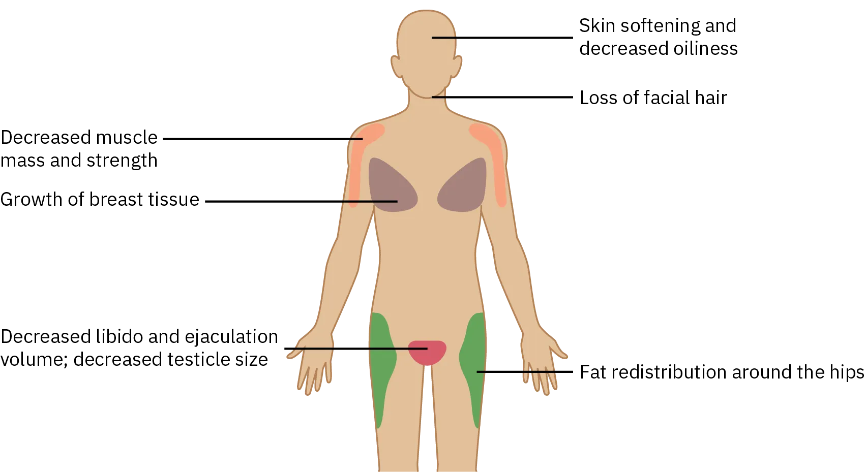 A diagram shows the areas of the body that are altered by drugs used for M T F transition. On the face, the skin softens and oiliness is decreased. On the face and chest, facial and body hair growth is slowed and thinned. Chest growth increases while muscle mass and strength decrease. Fat redistribution occurs in the thighs. The medicine also decreases libido, spontaneous arousal, testicular volume, and sperm production, as well as causing erectile dysfunction.