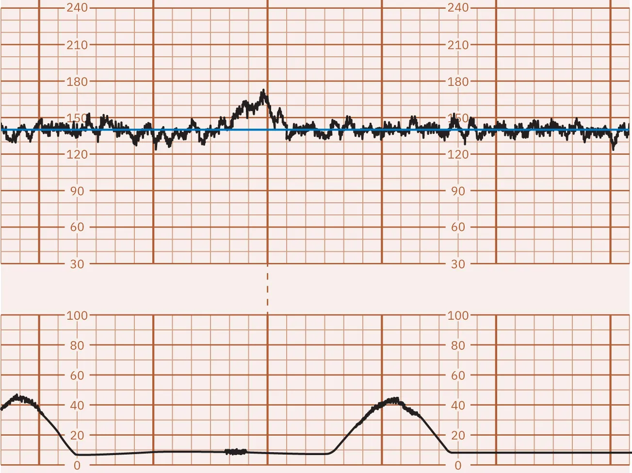 Fetal heart rate baseline monitor reading.